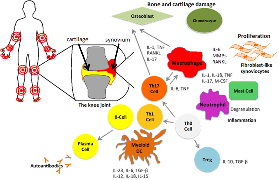 Артрит схема. Иммунопатогенез ревматоидного артрита. Rheumatoid Arthritis Pathophysiology. Иммунопатогенез ревматоидного артрита презентация.